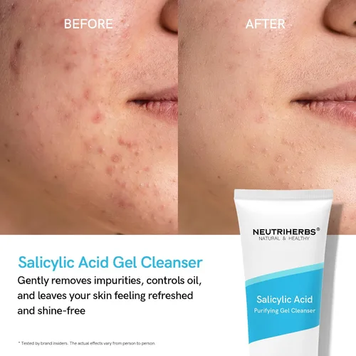 Vista 4 de Neutriherbs Limpiador de gel de ácido salicílico, lavado facial con control de aceite propenso al acné, desatasca los poros, elimina el lavado