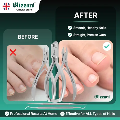 Vista 5 de Blizzard Juego de herramientas de podología – cortaúñas para uñas gruesas – 5 pinzas de uñas para podólogos para personas mayores – Cortaúñas