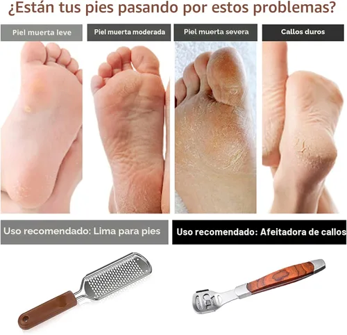 Vista 5 de Raspa de pie colosal y afeitadora de callos con mango de madera (10 cabezales de repuesto y 1 lima), kit de lima de pie de pedicura, raspador
