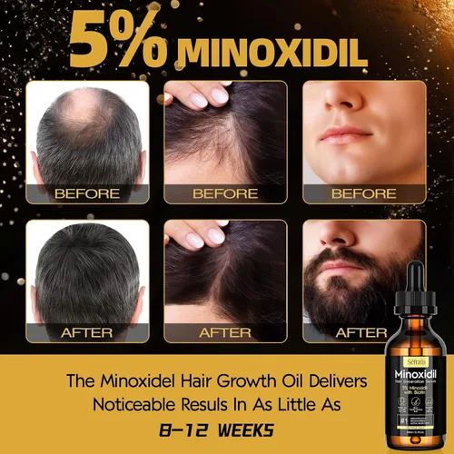 Vista 2 de 5% Minoxidil Suero de Crecimiento Capilar en Aceite para Hombres y Mujeres, Suero Capilar de Biotina, Tratamiento de Recrecimiento Capilar Más