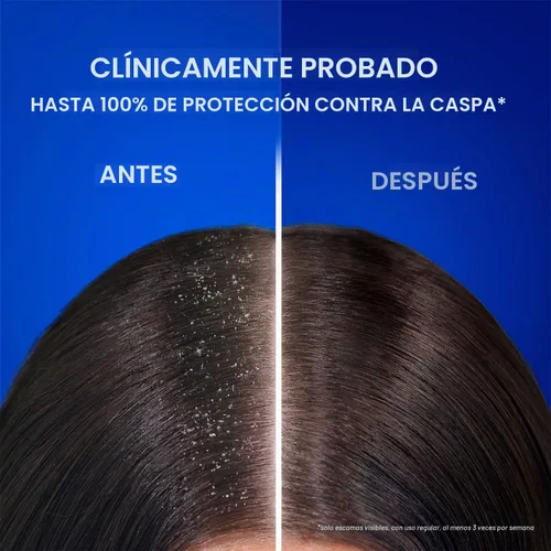 Vista 8 de Head & Shoulders Champú anticaspa (Mentol fresco y energiza el cuero cabelludo) - 1L