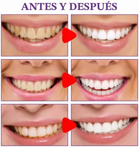 Vista 4 de Pasta de dientes probióticos para el mal aliento, pasta de dientes equilibrada del aire del océano (1 piezas)