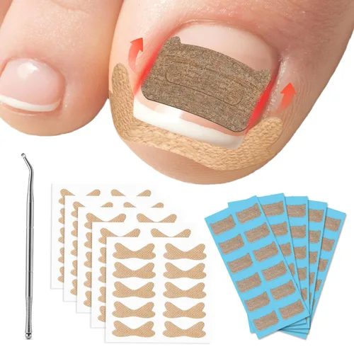 Vista 7 de FVION Juego de corrector de uñas encarnadas – 40 tiras alisadoras de uñas encarnadas sin dolor con levantador de uñas de los pies – Solución eficaz