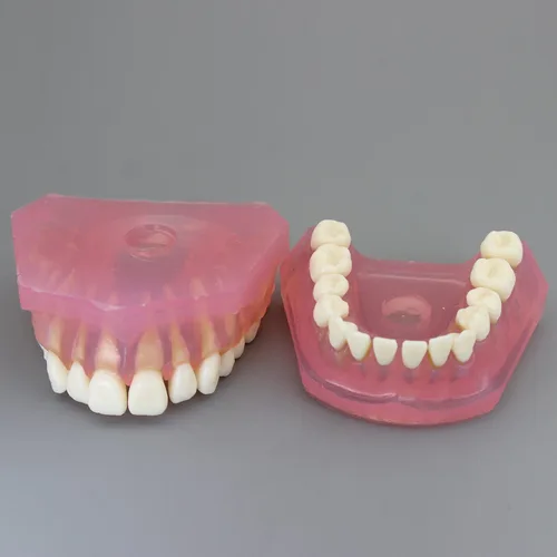 Vista 8 de Modelo de dientes de implante dental con dientes extraíbles para profesionales dentales y estudiantes