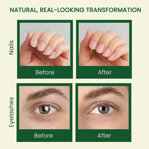 Vista 4 de Aceite de ricino puro (10 onzas), aceite de ricino 100% prensado en frío para el crecimiento del cabello, piel, cejas, pestañas de ojos, uñas