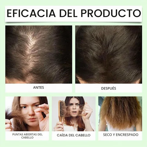 Vista 6 de Anti-Hair Fall Hair Loss Shampoo, Nourishing and Conditioning Shampoo Enriched with Multiple Botanical Extracts, Mild and Non-Irritating for All